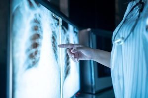 A doctor analyzing and pointing at the xray of patient