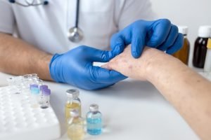 A medical professional in scrubs checking Allergies and skin disorders on hand of a patient