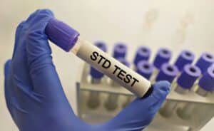 A close of a hand in gloves holding a sample tube for STD testing