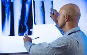 A doctor examining the X-ray of patient